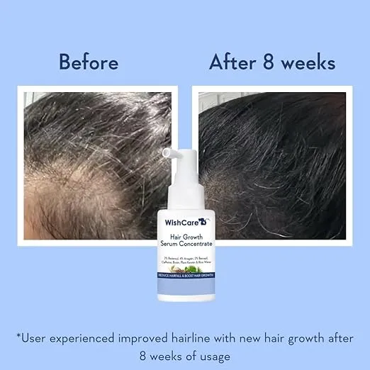 Hair Growth Serum Concentrate - Rosemary, 3% Redensyl, 4% Anagain, 2% Baicapil, Caffeine, Biotin, Plant Keratin & Rice Water